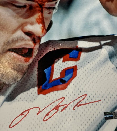Mark Messier Signed Rangers 11x14 Bloody Mess Photo Framed Mint Auto Steiner HOF
